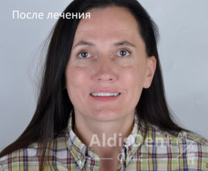 Клинический случай 6. Гнатология, имплантация, ортопедия