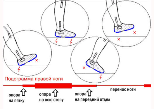 Последовательная дезокклюзия, или Как жевать «с пятки на носок»