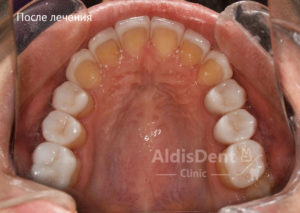 Клинический случай 10. Гнатология, эстетика