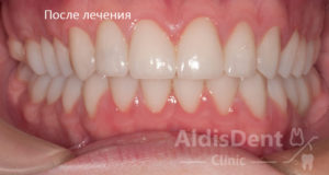 Клинический случай 9. Гнатология, эстетика