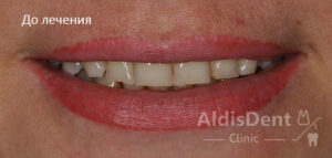 Клинический случай 3. Гнатология, ортопедия