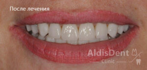 Клинический случай 3. Гнатология, ортопедия