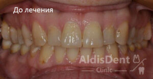 Клинический случай 11. Гнатология, эстетика