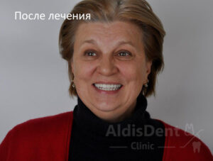 Клинический случай 5. Имплантация, гнатология, ортопедия