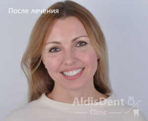 Клинический случай 7. Имплантация, гнатология, ортопедия