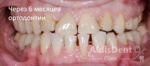 Клинический случай 1. Гнатология, ортодонтия, ортопедия